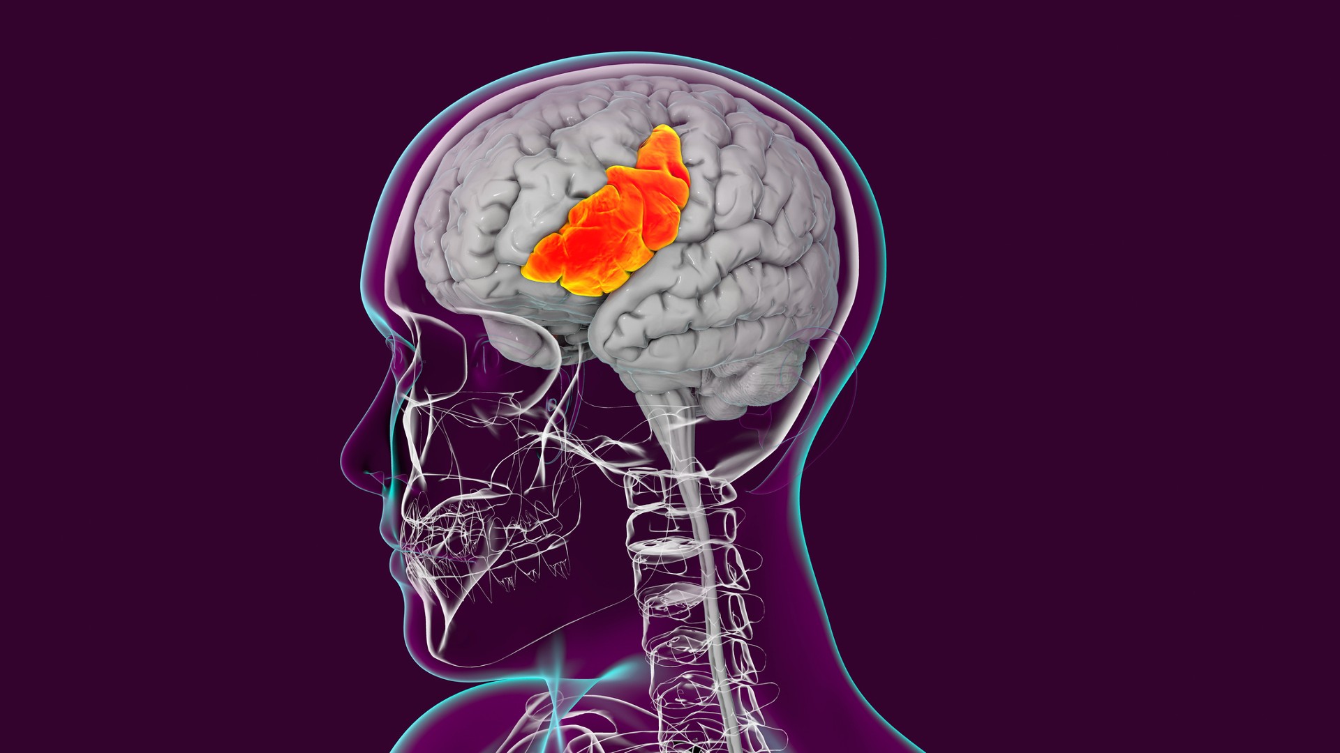 Човешки мозък с подчертана долна фронтална извивка, изобразен в ярко червено и оранжево отстрани на мозъка, над мястото, където би било ухото