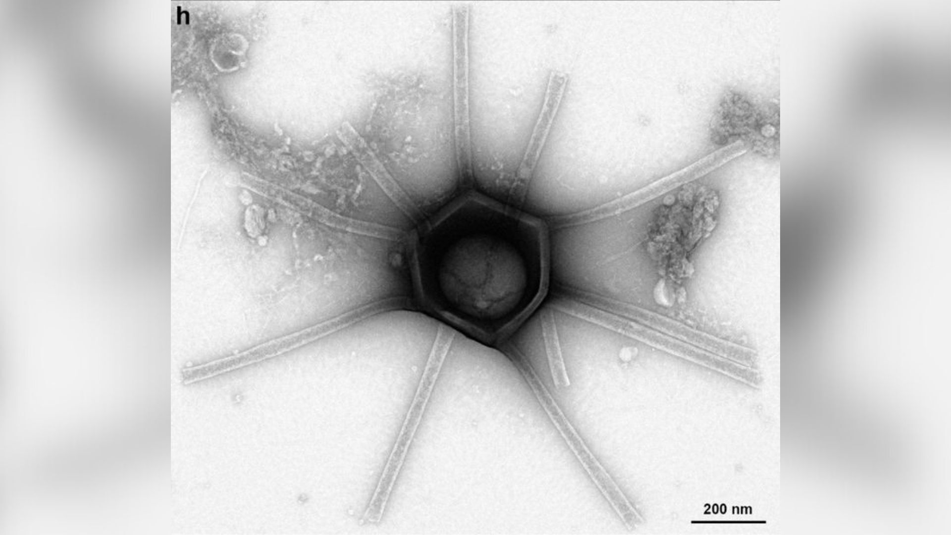 Вирус с дълги тръбести придатъци, както се вижда под микроскоп