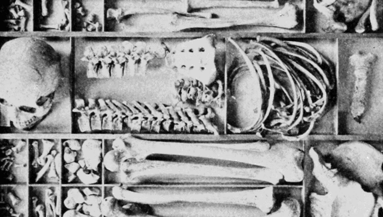 Човешки скелет в кутия